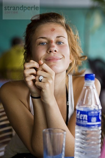 Eine skandinavische Teenagerin mit einer Wunde in ihrer Stirn verursacht durch Surfen Indien