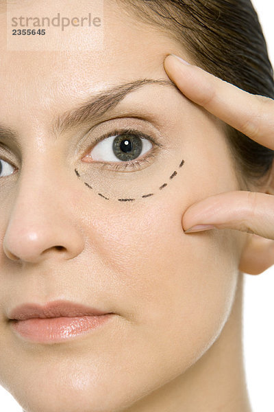 Frau mit plastischen Operationsmarkierungen unter einem Auge  berührendes Gesicht  Blick in die Kamera