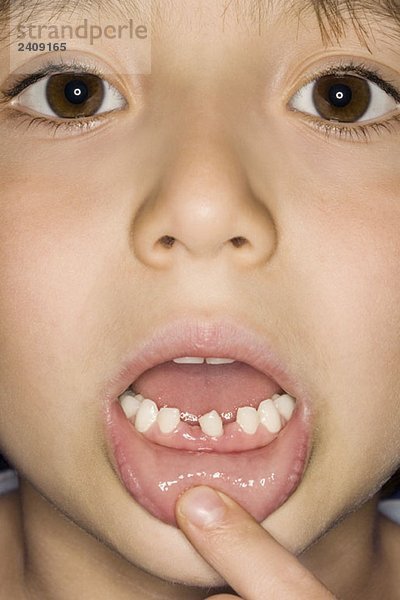 Ein Junge  der seine fehlenden Zähne zeigt.