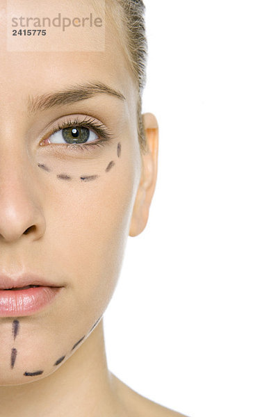 Frau mit plastischen Operationsmarkierungen im Gesicht  Nahaufnahme  Schnittansicht