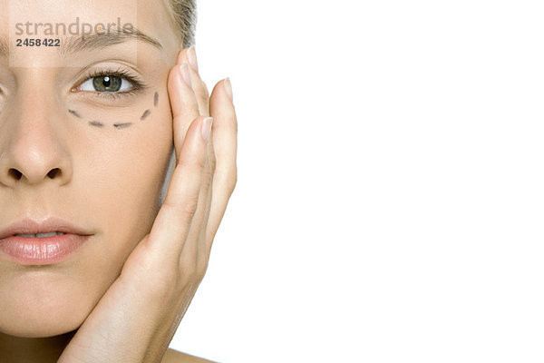 Frau mit plastischen Operationsmarkierungen unter dem Auge  Nahaufnahme  Ausschnitt