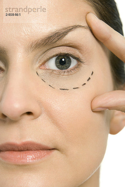 Frau mit plastischen Operationsmarkierungen unter einem Auge  berührendes Gesicht  Blick in die Kamera  Nahaufnahme