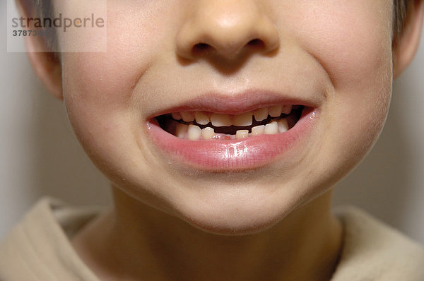 Mund mit erster Zahnlücke eines sechsjährigen Jungen