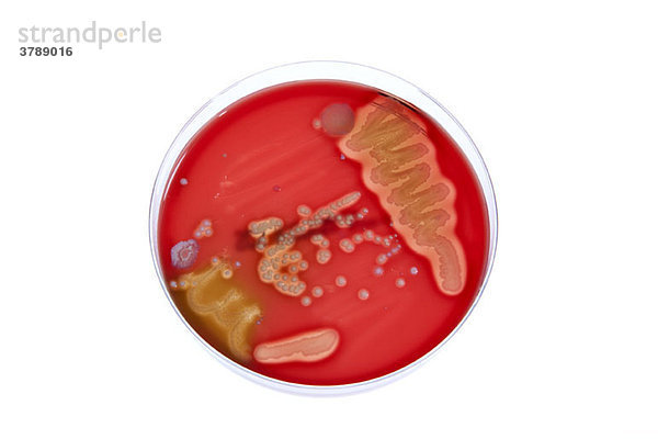 Eine in einer Petrischale wachsende Bakterienkultur
