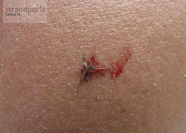 Getöteter Moskito (Culicidae) auf Haut