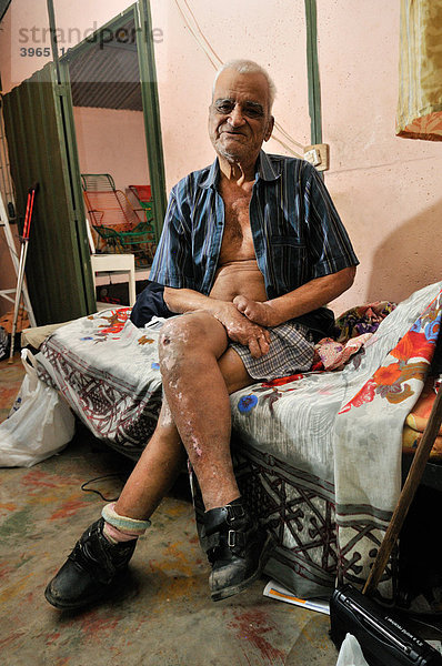 Lepra-Patient  78 Jahre  mit verkrüppelten Händen und Verletzungen an den Beinen  Lepra-Kolonie Agua de Dios  Kolumbien  Südamerika