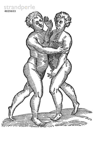 Holzschnitt  Gemelli pectoribus connexi  Siamesische Zwillinge  Aldrovandi  Historia Monstrorum  1642  Renaissance