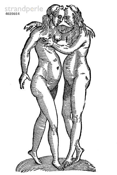 Holzschnitt  Gemellae frontibus cohaerentes  Siamesische Zwillinge  Aldrovandi  Historia Monstrorum  1642  Renaissance
