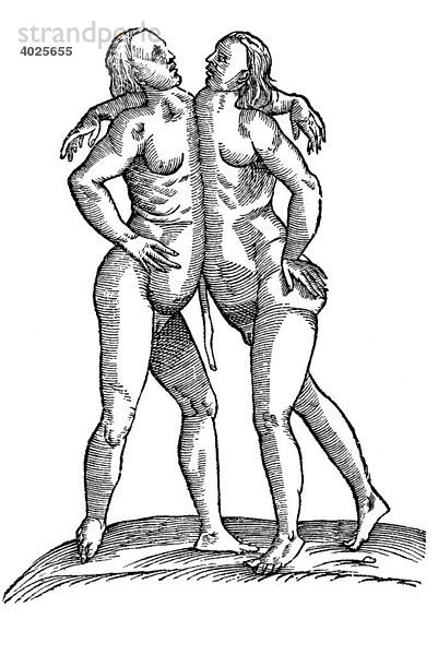 Holzschnitt  Icon gemellarum parei  Siamesische Zwillinge  Aldrovandi  Historia Monstrorum  1642  Renaissance