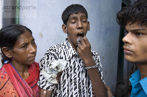 Mit menschenwürdiger Behandlung von Behinderten ist es in der indischen Gesellschaft nicht weit her. Ein behinderter Junge wird in den Slums von seiner Mutter und seinem Bruder an die frische Luft geführt. Um seine Handgelenke und Fesseln trägt er Ketten mit Vorhängeschlössern. Die Vermutung liegt nahe  dass er im Haus normalerweise angekettet ist. Howrah  Hooghly  Westbengalen  Indien