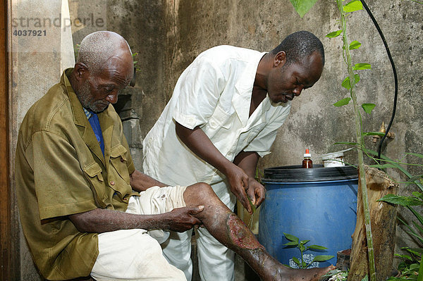 Naturheiler behandelt das kranke Bein eines Patienten  Yaounde  Kamerun  Afrika