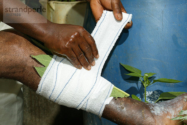 Naturheiler behandelt das kranke Bein eines Patienten  Yaounde  Kamerun  Afrika