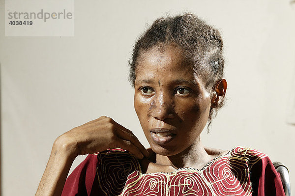 AIDS/HIV infizierte Frau  Portrait  Hospital  Manyemen  Kamerun  Afrika