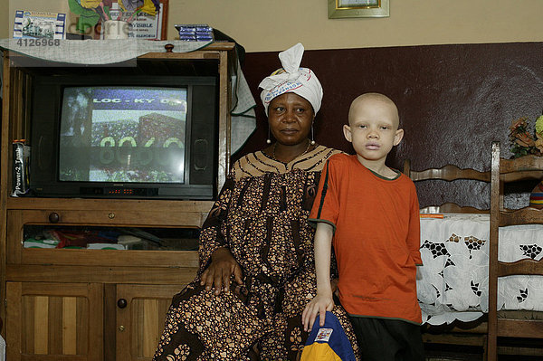 Mutter und Albino-Junge im Wohnzimmer  Douala  Kamerun  Afrika