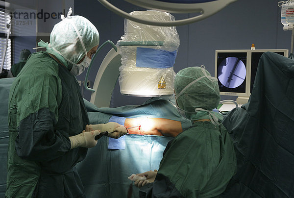 Entfernen einer Knochenschraube im Unterschenkel  mit Hilfe eines Röntgenbildwandlers
