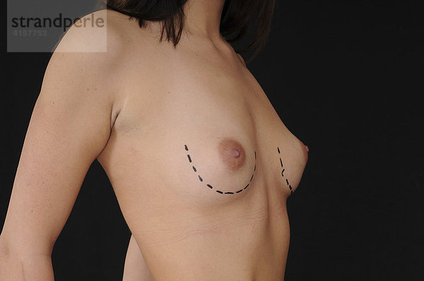 Oberkörper  Busen  Brust vor Schönheitsoperation mit Zeichnung für Operation  Linien  Silikon  vor Schwarz