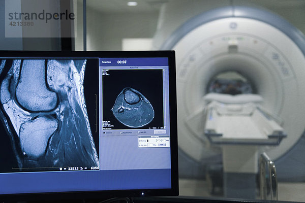 MRI-Scan-Ergebnis auf dem Computermonitor