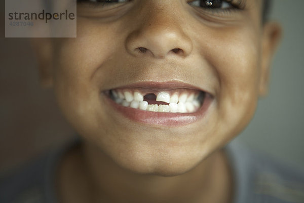 7 Jahre alten Jungen Lächeln in die Kamera mit fehlenden Zahn  Toronto  Kanada