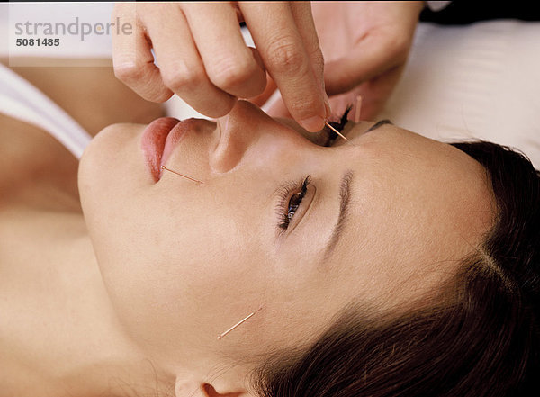 Frau mit Akupunktur-Behandlung auf Gesicht