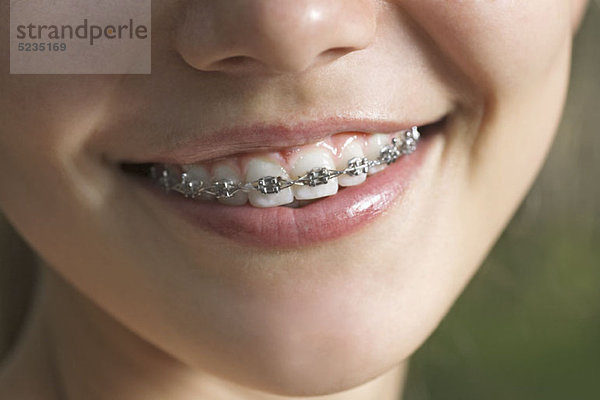 Ein lächelnder Teenager mit Zahnspange  ECU