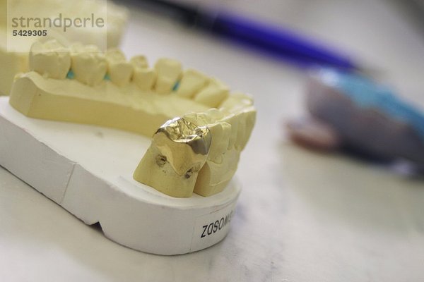 Zahnmodell mit Goldkrone