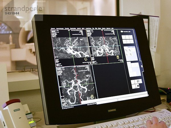 Computergrafik MRT eines Schädels - Magnetresonanztomographie - Kernspinntomographie