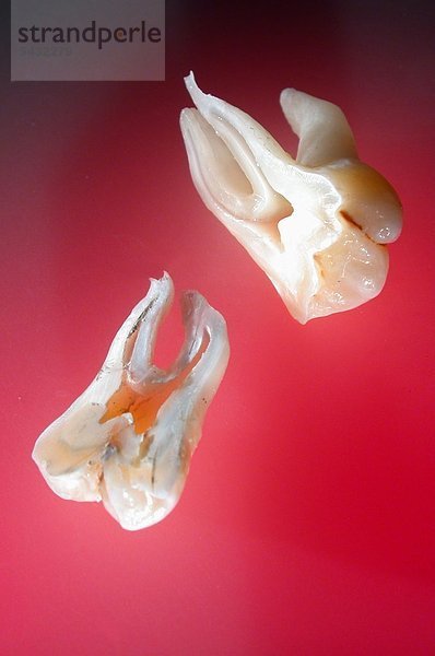 Querschnitt Backenzahn mit Zahnwurzel