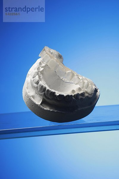 Obere Beißschiene für Oberkiefer auf Gipsmodell vor blauem Hintergrund ( Orthoarch - lat.) - Bruxismus - bruxism - das meist unbewusste nächtliche Knirschen mit den Zähnen - durch das Knirschen mit den Zähnen treten in den meisten Fällen Fehlbelastungen der Zähne bzw. Zahngruppen oder Kiefergelenksbeschwerden auf - um eine Entlastung der Zähne und eine Gelenkschonung bei Kieferarthropathie zu erreichen wird eine individuell angepasste Kunststoffplatte   Knirscherschiene   Aufbissbehelf ( Okklusionsschiene oder Relaxierungsschiene ) für den Patienten angefertigt - diese sollte vorwiegend nachts getragen werden - Ursachen können psychischer ( Stress )   physischer ( Skeletterkrankungen ) oder neurologischer ( MS Multiple Sklerose ) Natur sein
