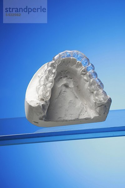 Untere Beißschiene für Unterkiefer auf Gipsmodell vor blauem Hintergrund ( Orthoarch - lat.) - Bruxismus - bruxism - das meist unbewusste nächtliche Knirschen mit den Zähnen - durch das Knirschen mit den Zähnen treten in den meisten Fällen Fehlbelastungen der Zähne bzw. Zahngruppen oder Kiefergelenksbeschwerden auf - um eine Entlastung der Zähne und eine Gelenkschonung bei Kieferarthropathie zu erreichen wird eine individuell angepasste Kunststoffplatte   Knirscherschiene   Aufbissbehelf ( Okklusionsschiene oder Relaxierungsschiene ) für den Patienten angefertigt - diese sollte vorwiegend nachts getragen werden - Ursachen können psychischer ( Stress )   physischer ( Skeletterkrankungen ) oder neurologischer ( MS Multiple Sklerose ) Natur sein