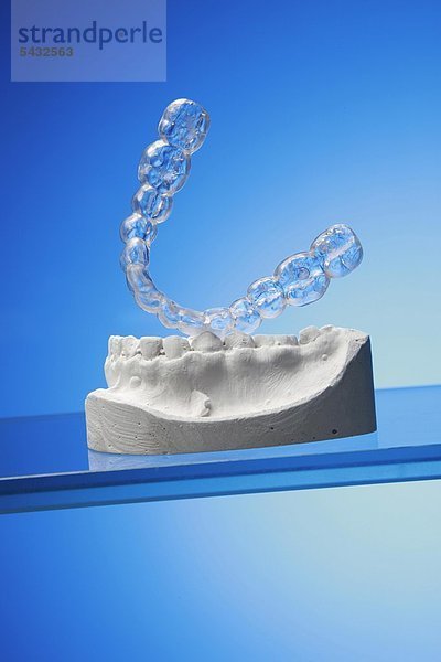 Untere Beißschiene für Unterkiefer auf Gipsmodell vor blauem Hintergrund ( Orthoarch - lat.) - Bruxismus - bruxism - das meist unbewusste nächtliche Knirschen mit den Zähnen - durch das Knirschen mit den Zähnen treten in den meisten Fällen Fehlbelastungen der Zähne bzw. Zahngruppen oder Kiefergelenksbeschwerden auf - um eine Entlastung der Zähne und eine Gelenkschonung bei Kieferarthropathie zu erreichen wird eine individuell angepasste Kunststoffplatte   Knirscherschiene   Aufbissbehelf ( Okklusionsschiene oder Relaxierungsschiene ) für den Patienten angefertigt - diese sollte vorwiegend nachts getragen werden - Ursachen können psychischer ( Stress )   physischer ( Skeletterkrankungen ) oder neurologischer ( MS Multiple Sklerose ) Natur sein