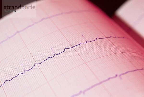 Kurve eines EKG Herz Elektrokardiograph - Elektrokardiographie