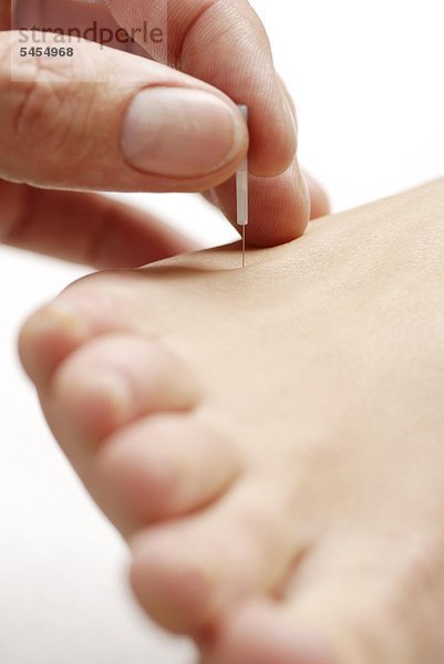 Akupunktur am Fuß