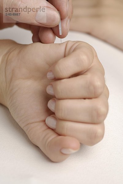 Akupunktur an der Hand