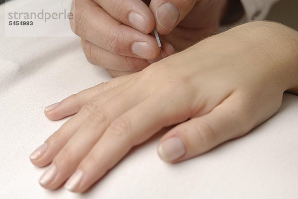 Akupunktur am Handrücken