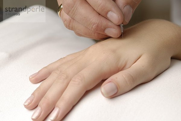 Akupunktur am Handrücken
