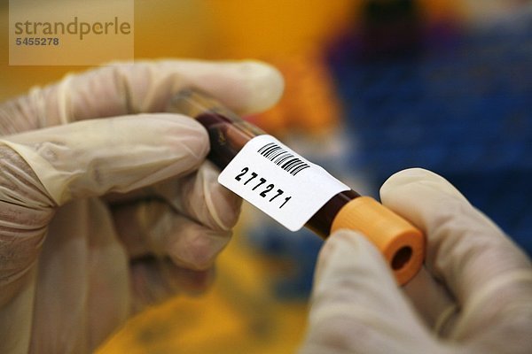 Laborant hält ein Blutentnahmeröhrchen