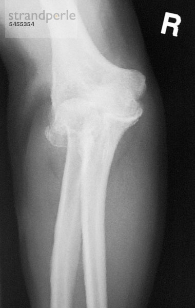 Röntgenbild eines Knies