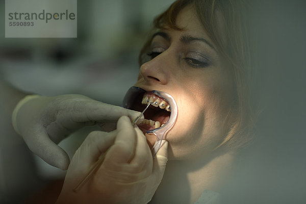 Patientin beim Einsetzen einer Zahnspange beim Zahnarzt