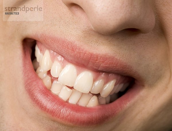 weiße Zähne