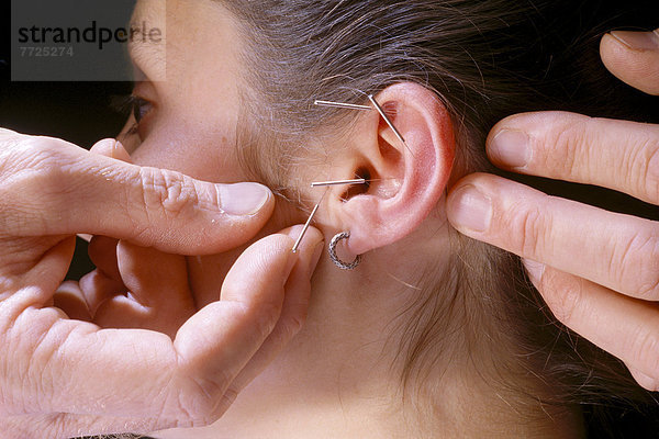 Acupuncture To Woman's Ear  Close-Up C1204