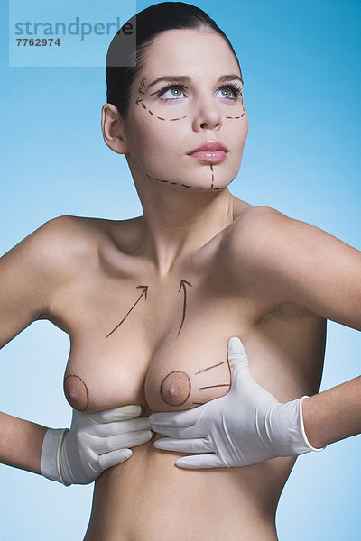 Junge Frau mit präoperativen Markierungen an Brust und Gesicht