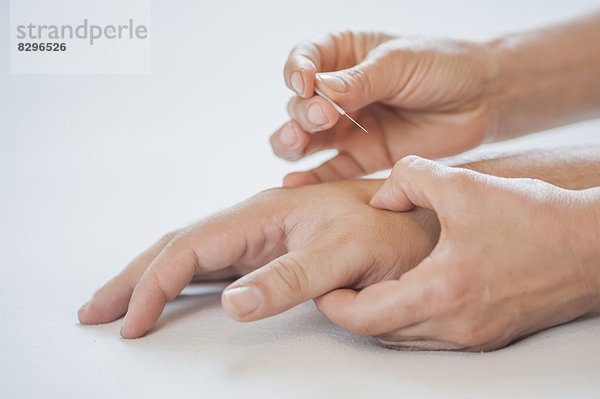 Traditionelle Chinesische Medizin  TCM  Akupunktur  Hand mit Akupunkturnadel während der Behandlung