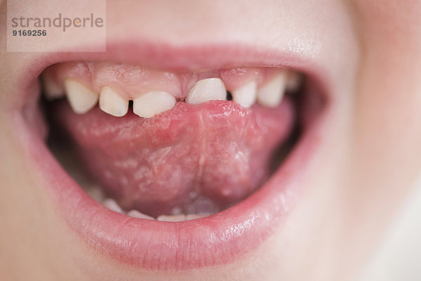 Caucasian girl wiggling loose tooth