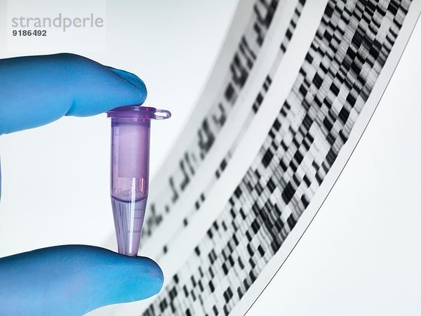 Genprobe und DNA-Autoradiogramm