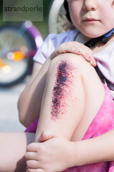 Junges Mädchen mit verletztem Bein  Nahaufnahme