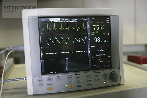Bildschirm des Elektrokardiogramm-Monitors (EKG)