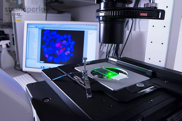 Krebsforschungslabor  Zellen unter dem Elektronenmikroskop