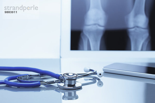 Akustisches Stethoskop und Smartphone auf dem Schreibtisch mit digitalem Tablett zur Anzeige des Knie-Röntgenbildes
