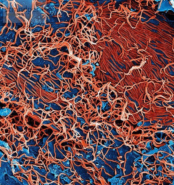Filamentöse Ebola-Viruspartikel (rot gefärbt) aus einer chronisch infizierten VERO E6-Zelle (blau gefärbt)