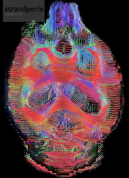 Koronale Ansicht der Gehirn-Konnektivität der Ratte. Draufsicht. Bilder rekonstruiert bei 300 Mikron isotropen